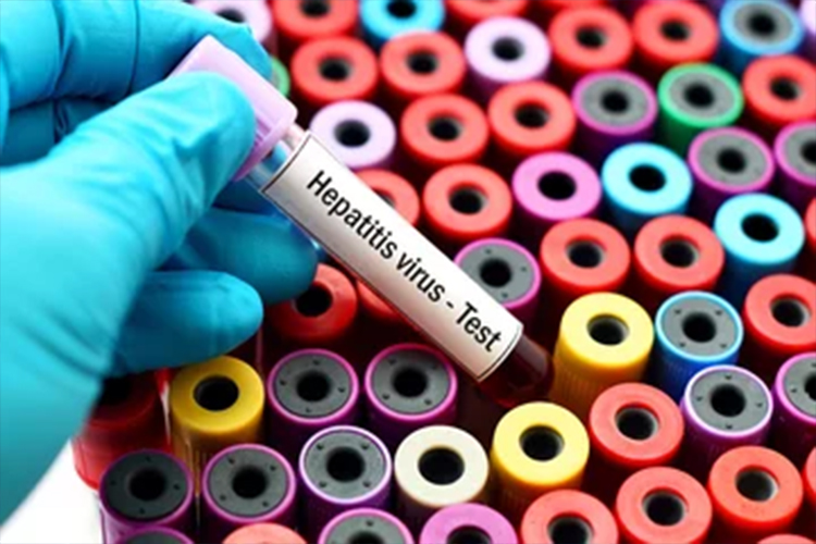 hepatitis-virus-test-tube